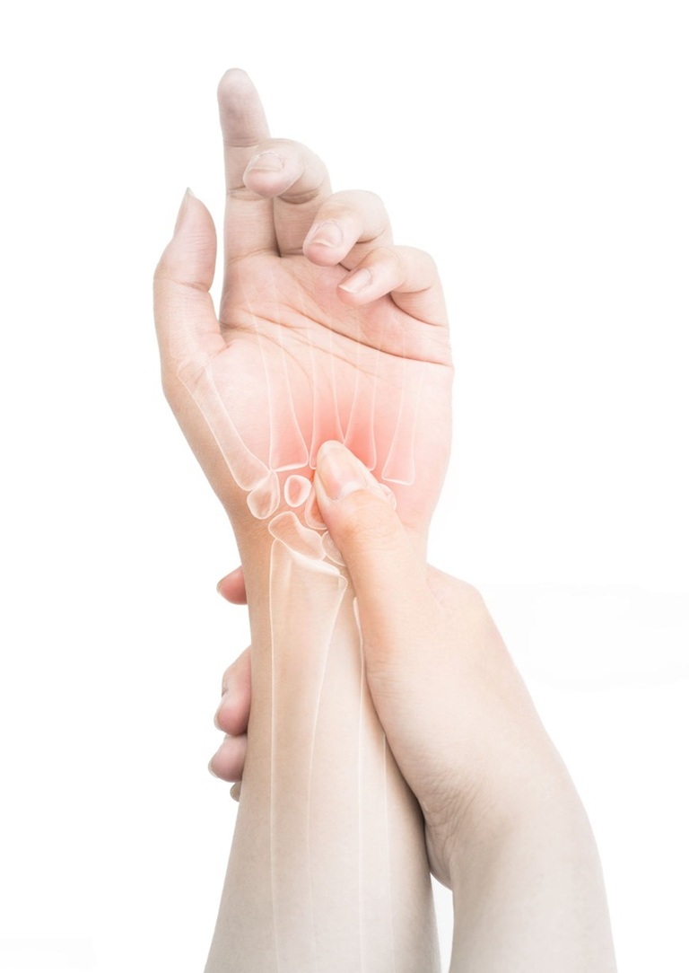 Carpal Tunnel Surgery Recovery Altrincham
